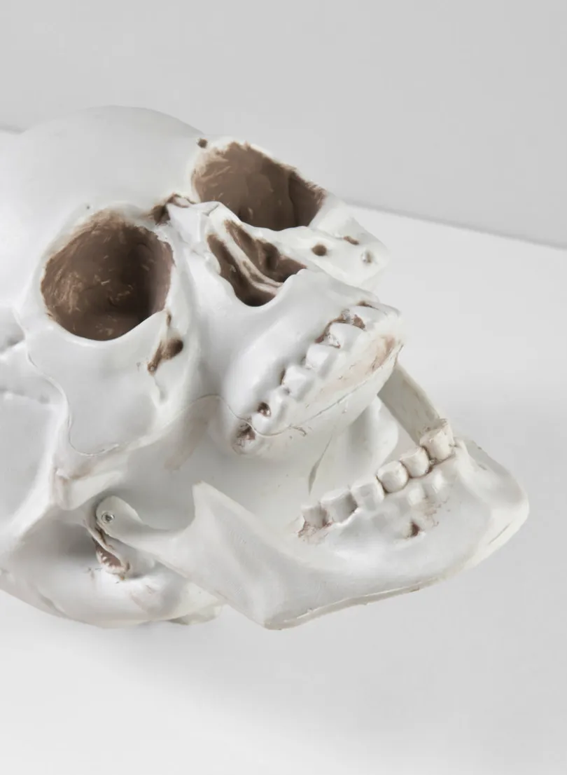 Uncle Alfred's Skull
